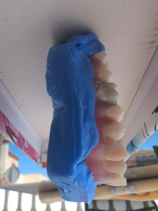 Tipodonto Dientes Naturales