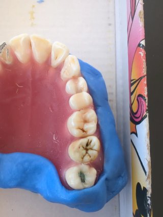 Tipodonto dientes naturales
