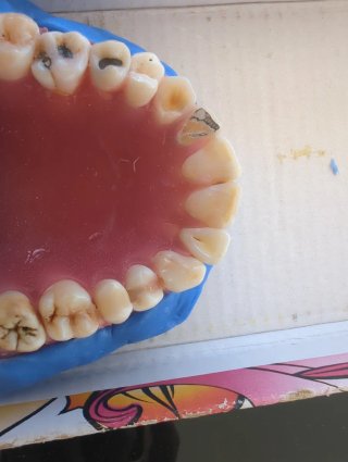 Tipodonto dientes naturales