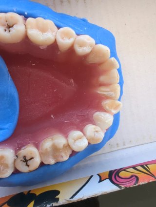 Tipodonto Dientes Naturales
