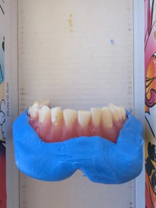 Tipodonto Dientes Naturales