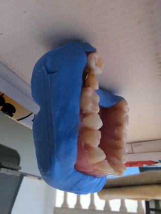 Tipodonto Dientes Naturales