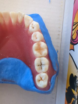 Tipodonto Dientes Naturales