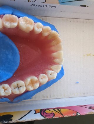 Tipodonto Dientes Naturales