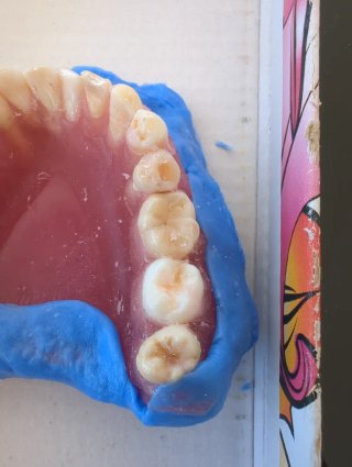 Tipodonto Dientes Naturales
