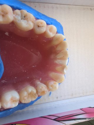 Tipodonto Dientes Naturales
