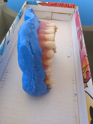 Tipodonto Dientes Naturales