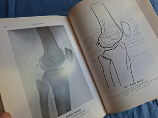 Atlas de anatomía humana Huesos, articulaciones...