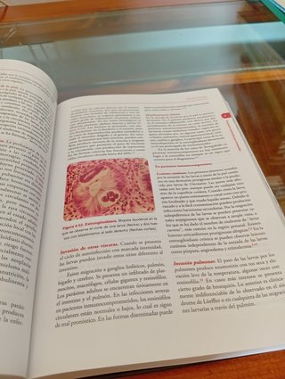 Parasitosis humanas