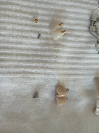 Lote de Muestras y Prótesis Dentales