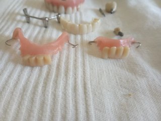 Lote de Muestras y Prótesis Dentales