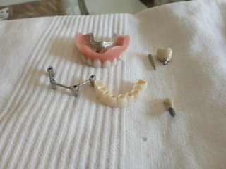 Lote de Muestras y Prótesis Dentales