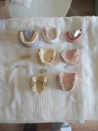 Lote de Muestras y Prótesis Dentales