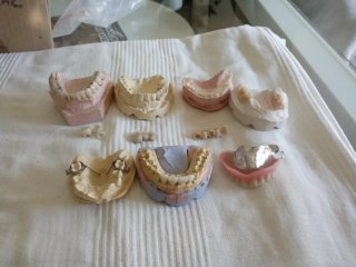 Lote de Muestras y Prótesis Dentales
