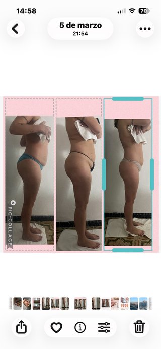 Masaje reductores con Madero terapia.
