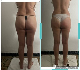 Masaje reductores con Madero terapia.