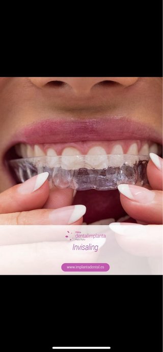 Prótesis dentales completas