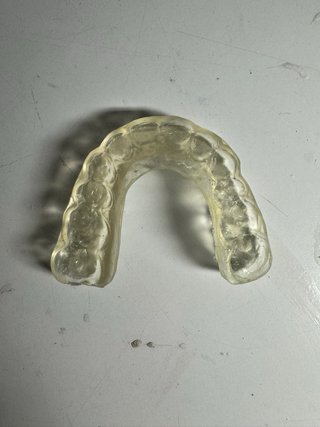 Prótesis dentales completas