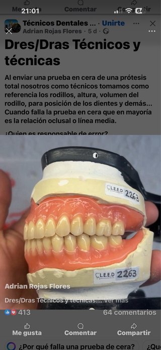 Prótesis dentales completas