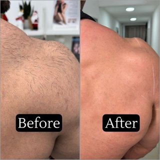 Masaje corporal Mujeres y hombres -Limpieza facial