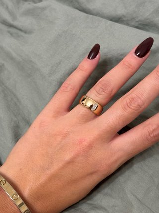 Anello Fabiani regolabile
