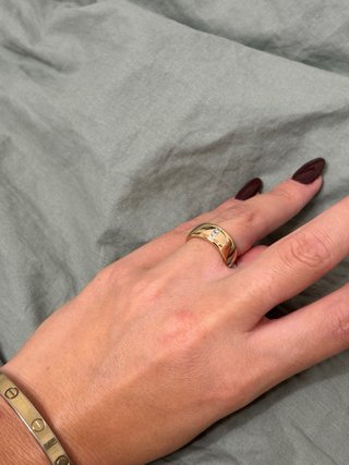 Anello Fabiani regolabile