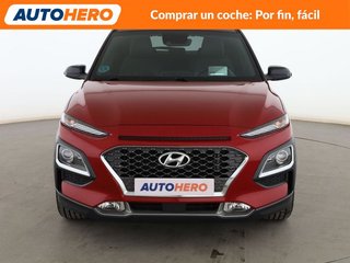 Hyundai Kona 1.6 CRDi Style
