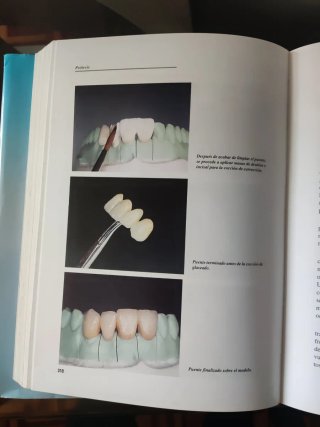 Manual del tecnico superior en protesis dentales