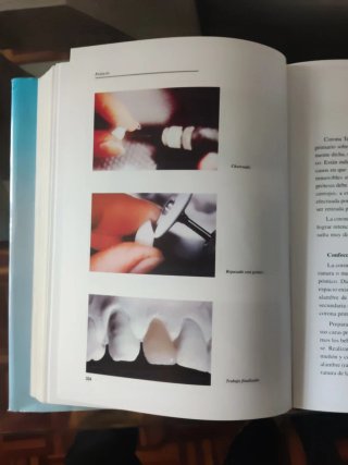 Manual del tecnico superior en protesis dentales