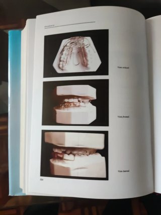 Manual del tecnico superior en protesis dentales