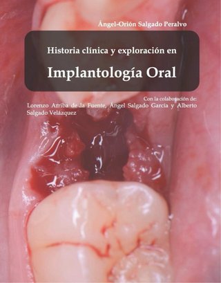 Historía clínica y exploración en Implantología...