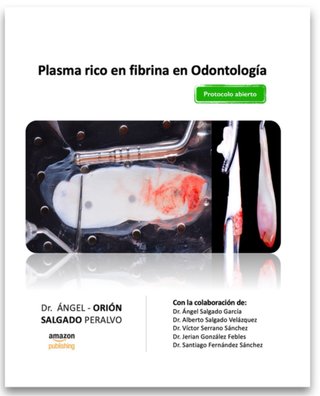 Plasma rico en fibrina en odontología "protocol...