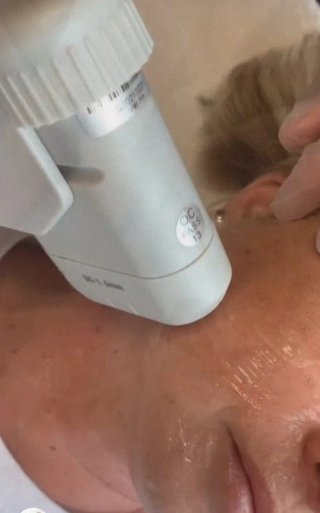 Dispositivo Hifu IR Medical