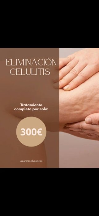 Tratamiento de Eliminación de Celulitis