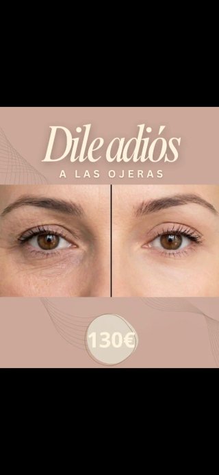 Tratamiento para ojeras