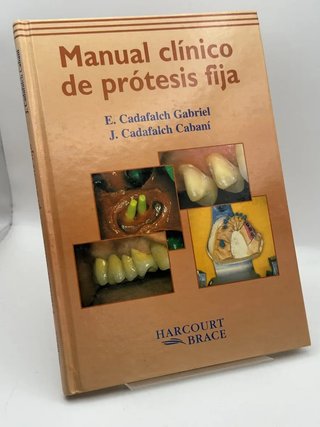 Manual Clinico De Protesis Fija - Cadafalch