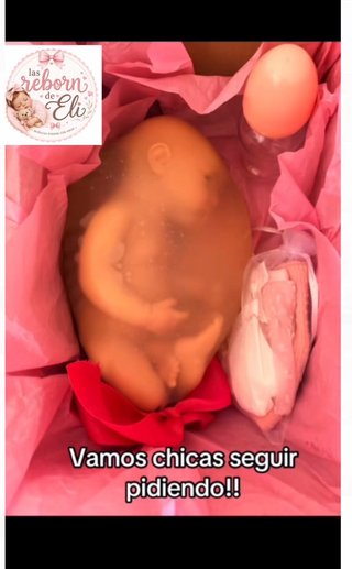 Bebé globo de silicona